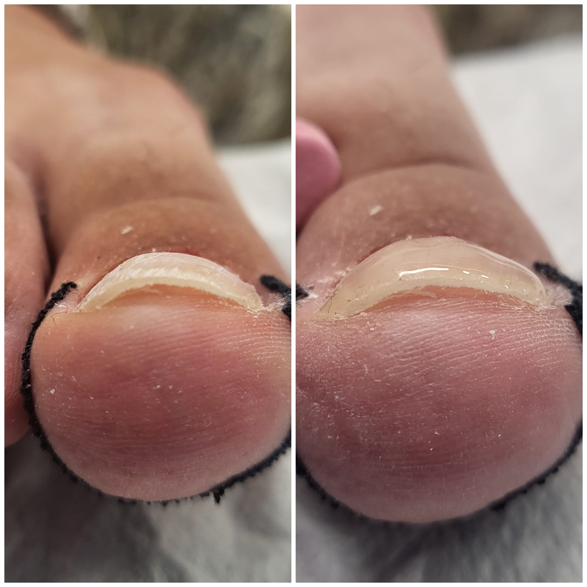 Gallery picture of LIFTUPGEL