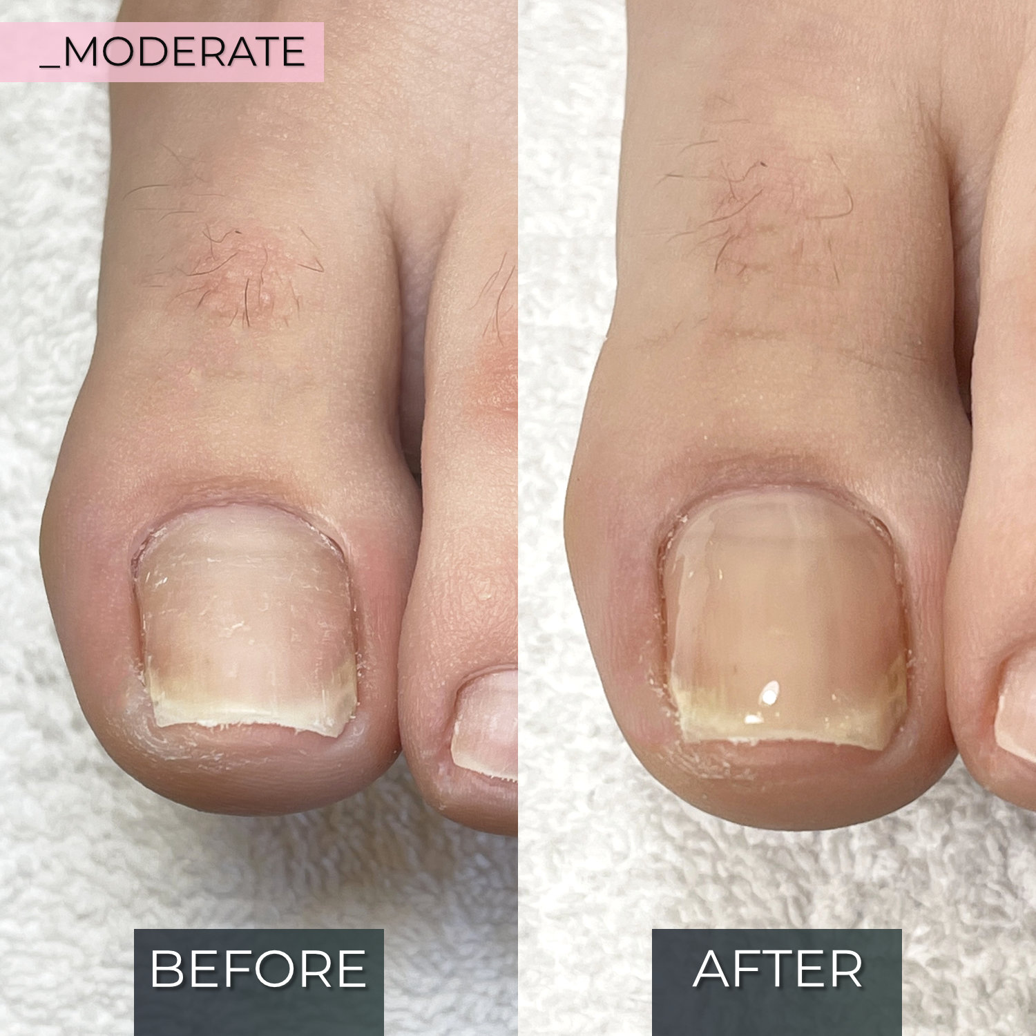 Application example 3