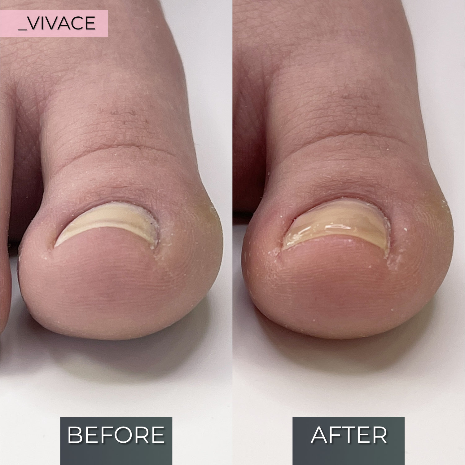 Application example 4